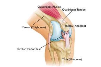 Can chiropractic help knee pain?