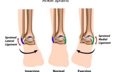 Ankles and Chiropractic